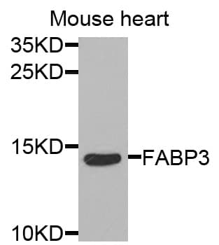 Polyclonal Rabbit anti-Human FABP3 / H-FABP Antibody (IHC, IF, WB)