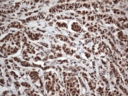 EWSR1 / EWS Antibody (aa256-447, clone OTI2B3)