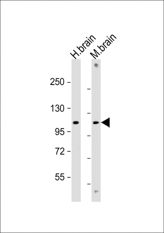 Polyclonal Rabbit anti-Human GBA2 Antibody (Internal, WB)