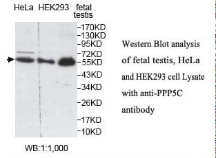 Polyclonal Rabbit anti-Human PPP5C Antibody (aa223-487, IHC, WB)