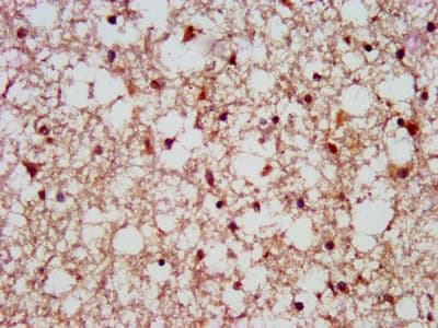 SCAMP1 / SCAMP Antibody