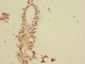 Polyclonal Rabbit anti-Human TNFAIP8 / SCC-S2 Antibody (IHC, WB)