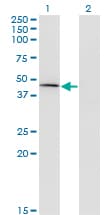 Monoclonal Mouse anti-Human CPA1 / Carboxypeptidase A Antibody (clone 3F11, WB)