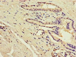 ACSF3 Antibody