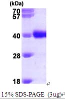 Human GALE / UDP-Glucose 4-Epimerase Protein (Recombinant His)