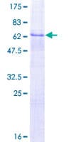 Human DLK1 / Pref-1 Protein (Recombinant GST)