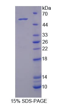 Human ACVR1C / ALK7 Protein (Recombinant His-T7)