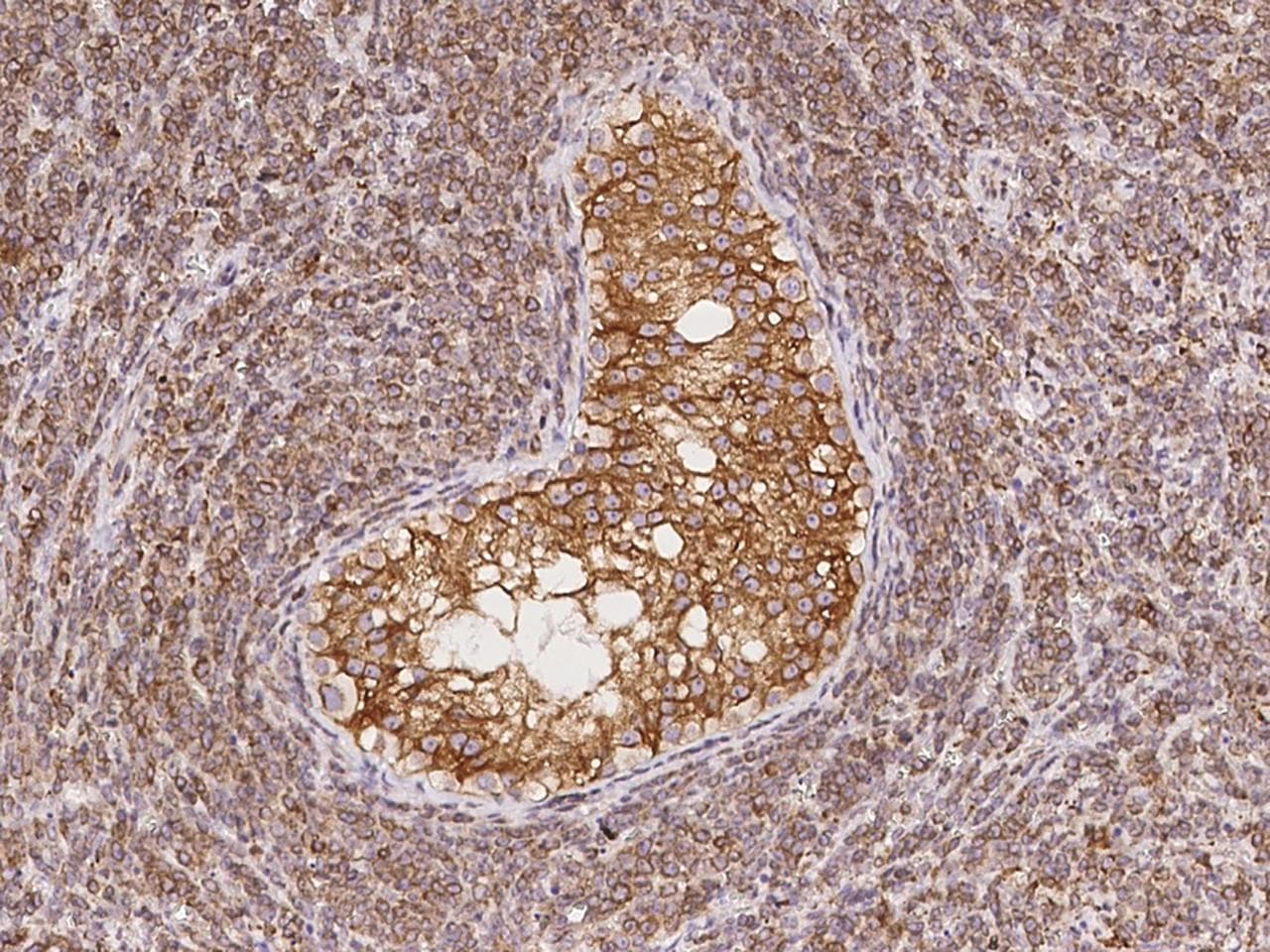 CDS2 Antibody