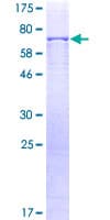 Human TUBG1 / Tubulin Gamma 1 Protein (Recombinant GST)