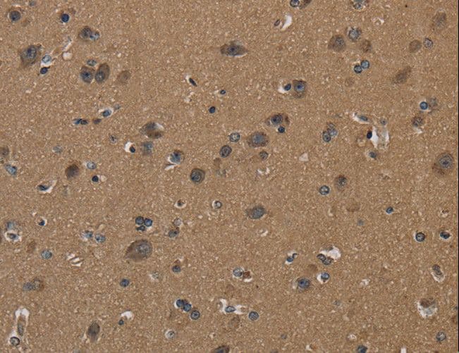 ICAM4 / CD242 Antibody