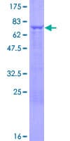 Human UMPS / OPRT Protein (Recombinant GST)