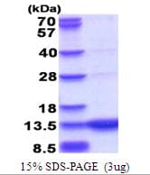 Human GCHFR Protein (Recombinant His)