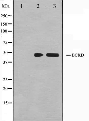 BCKDK Antibody