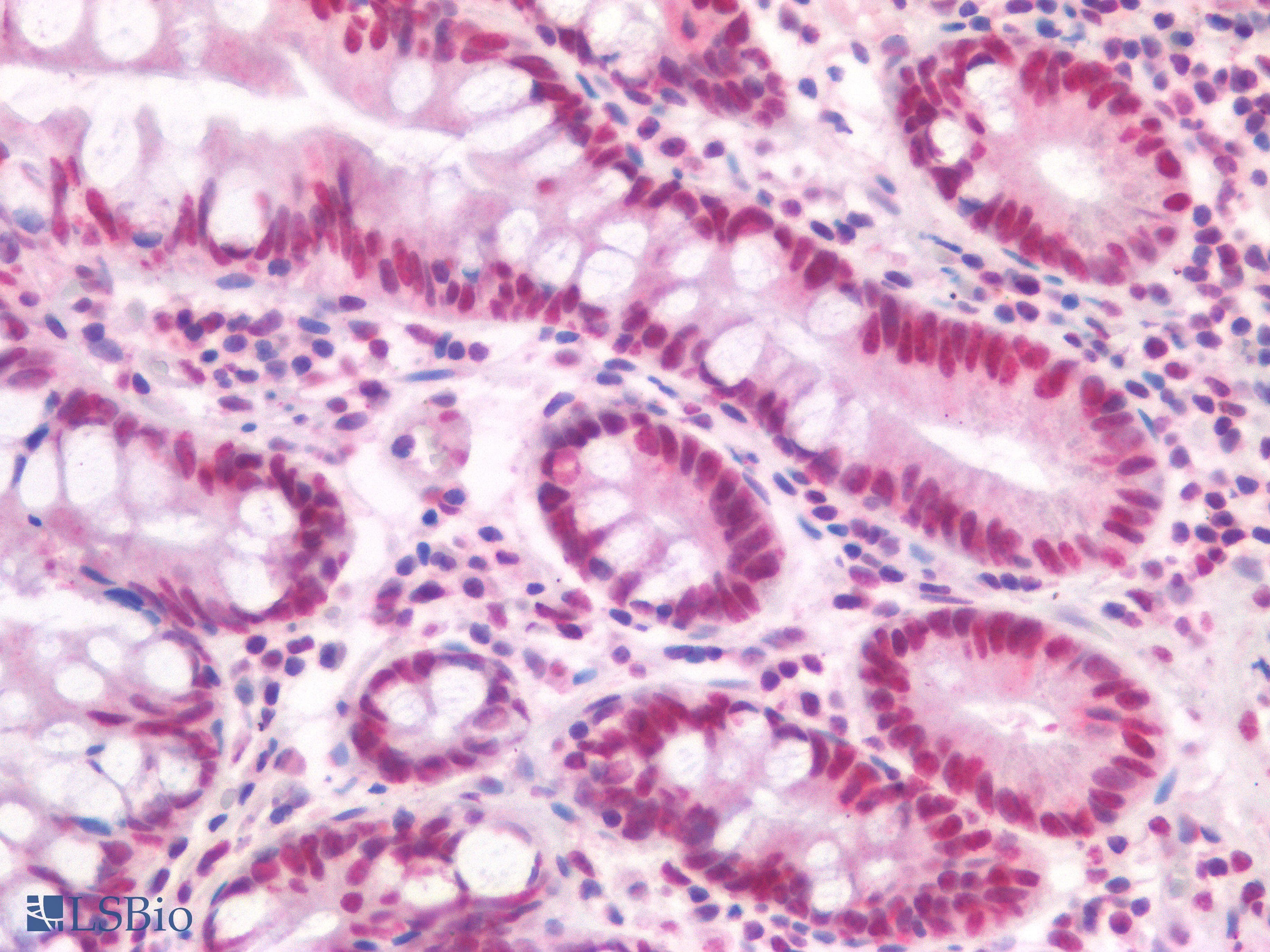 PathPlus™ TDP-43 / TARDBP Antibody (aa337-386)