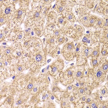 ST3GAL3 / ST3N Antibody