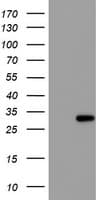 RFXANK Antibody (clone OTI2G7)