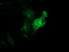 Monoclonal Mouse anti-Human TUBB4 / Tubulin Beta 4 Antibody (clone OTI5C1, IHC, IF, WB)