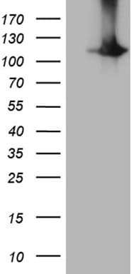 Monoclonal Mouse anti-Human HACE1 Antibody (clone OTI4F10, WB)