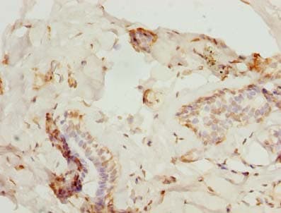 ZNF232 Antibody