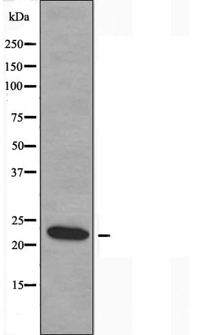 MOBKL2B / MOB3B Antibody