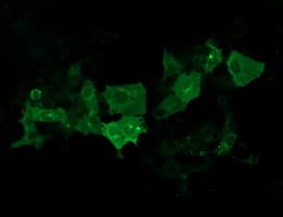CA12 / Carbonic Anhydrase XII Antibody (clone OTI2E9)