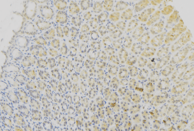 Polyclonal Rabbit anti-Human CYB5B Antibody (IHC, WB)
