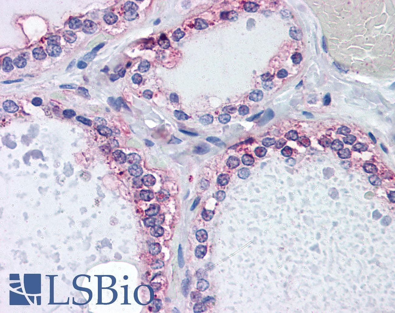 IHC-plus™ Monoclonal Mouse anti-Human CDKL2 Antibody (clone 1F6, IHC, WB)