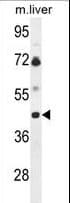 B3GNT5 Antibody (aa118-145)