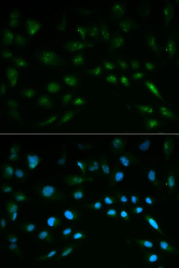 NFE2L2 / NRF2 Antibody