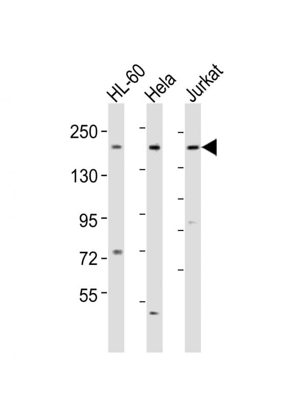 DIP2A Antibody (aa934-969)