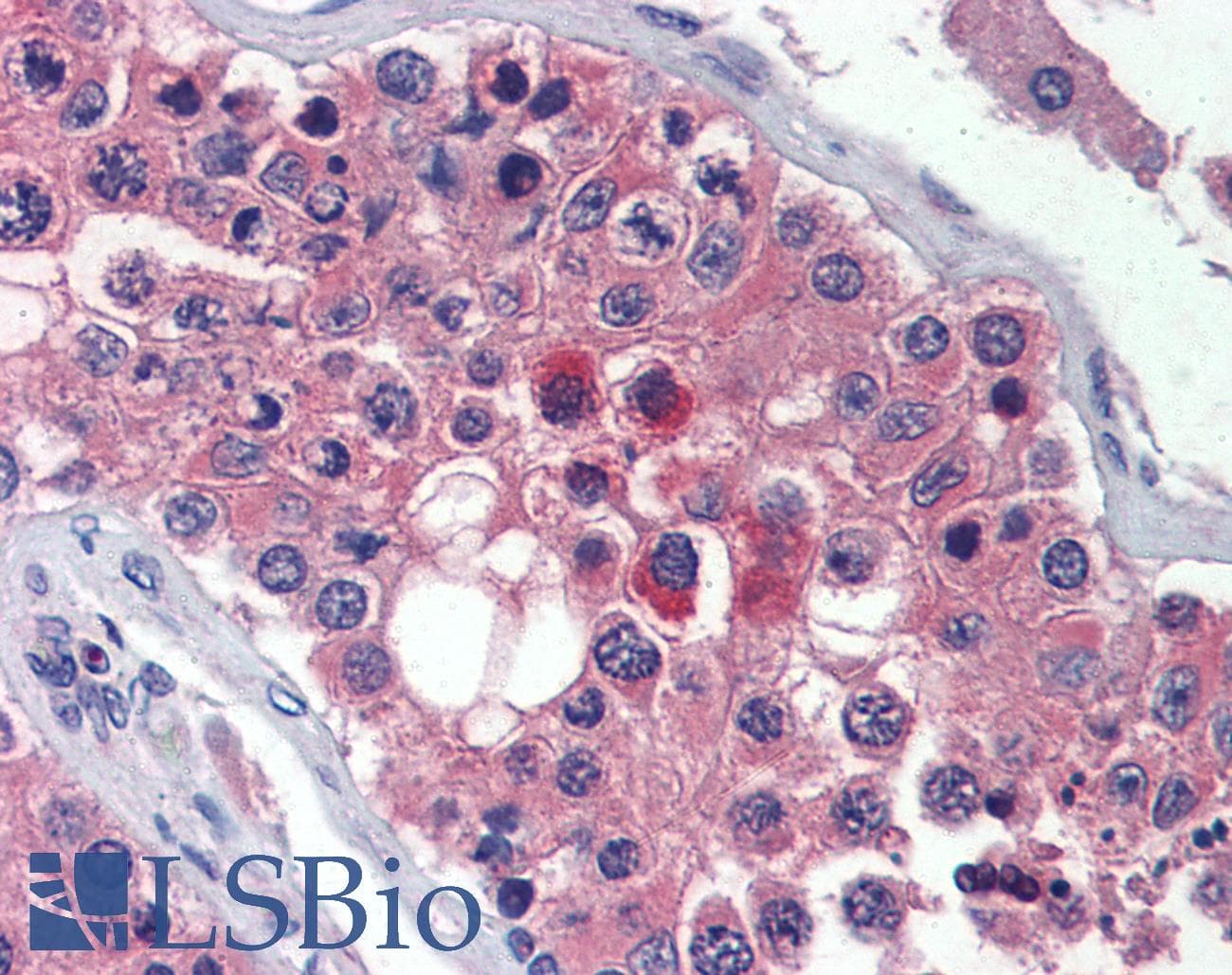 IHC-plus™ TMC8 / EVER2 Antibody