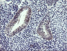 RTKN / Rhotekin Antibody (clone OTI1A4)