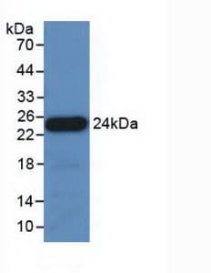 APOE / Apolipoprotein E Antibody