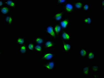 YWHAQ / 14-3-3 Theta Antibody (aa1-245)