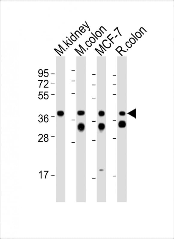 IHC-plus™ EPCAM Antibody (aa217-251)