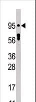 STAT5A Antibody (phospho-Tyr694)