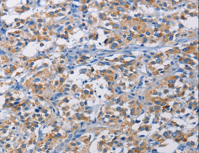 RICTOR Antibody