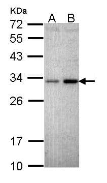 NQO1 Antibody