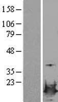 LSM4 Protein (Over-Expression Lysate Myc-DDK (Flag))