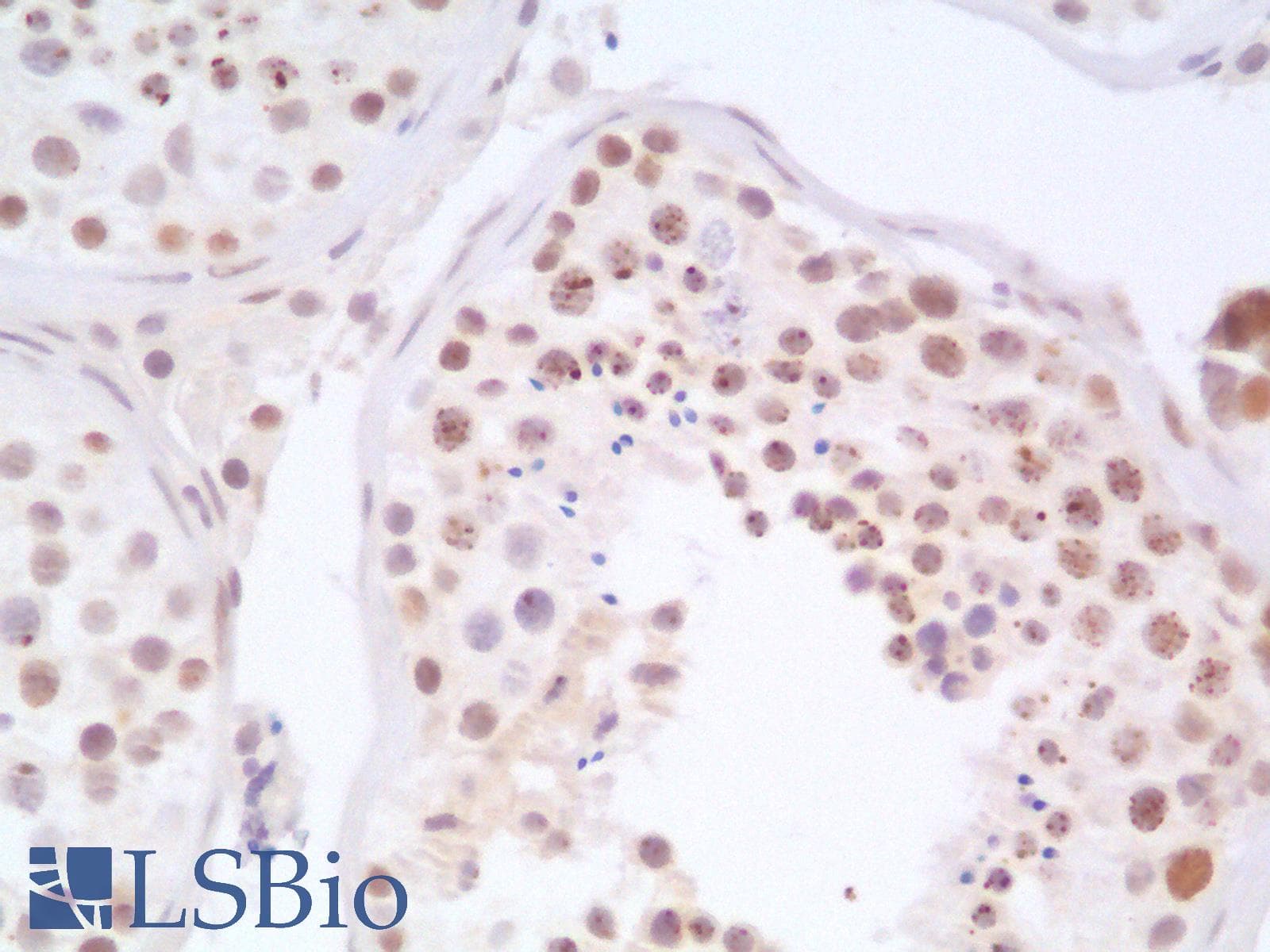 PathPlus™ TP53 / p53 Antibody (Concentrated)