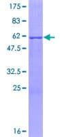 Human SIMPL / IRAK1BP1 Protein (Recombinant GST)