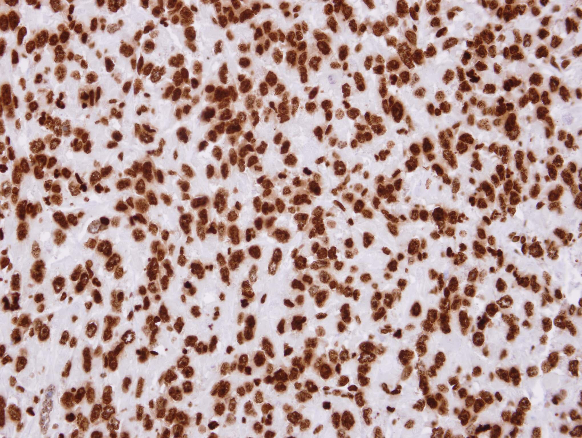 H2AFZ / H2A.z Antibody (C-Terminus)