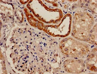 Polyclonal Rabbit anti-Human FBXW7 / FBW7 Antibody (IHC)