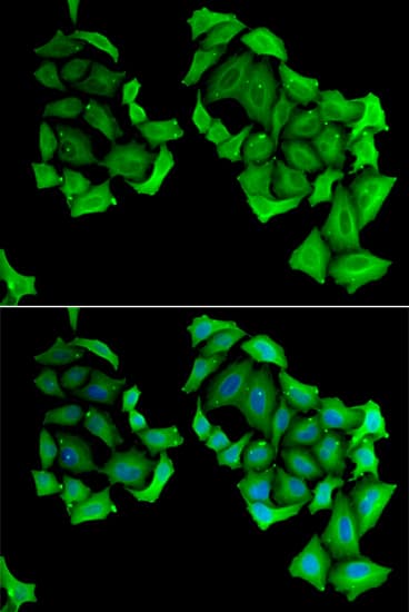C4BPB / C4BP Beta Antibody