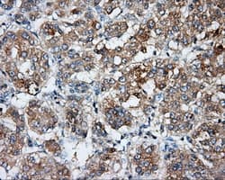 Basigin / Emmprin / CD147 Antibody (clone OTI5E1)