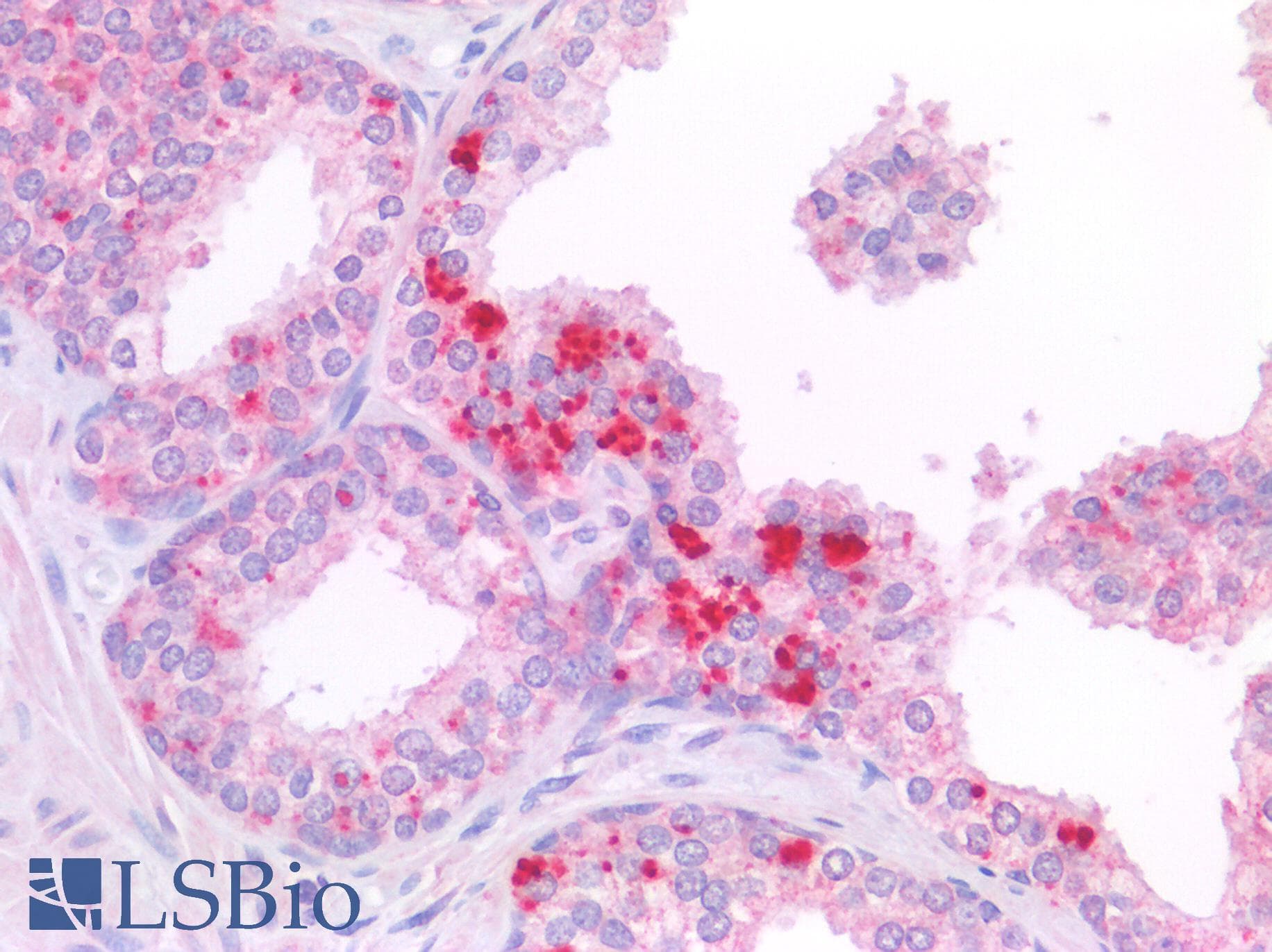 PathPlus™ Polyclonal Rabbit anti-Human c-Kit / CD117 Antibody (Extracellular Domain, IHC)
