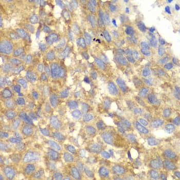 GCN2 Antibody