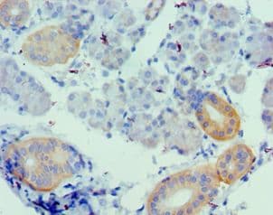 UTS2 / Urotensin II Antibody (aa35-124)