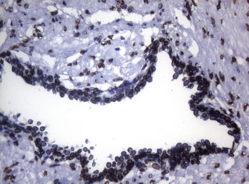 BCL6 Antibody (aa1-300, clone OTI1C3, Carrier-free)