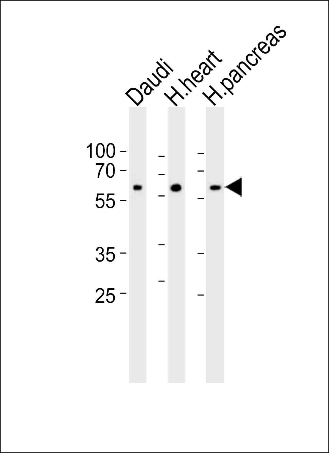 Polyclonal Rabbit anti-Human Syndapin I / PACSIN1 Antibody (aa8-38, IHC, WB)